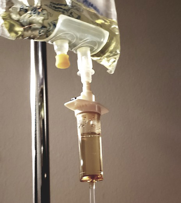 iv hydration pole